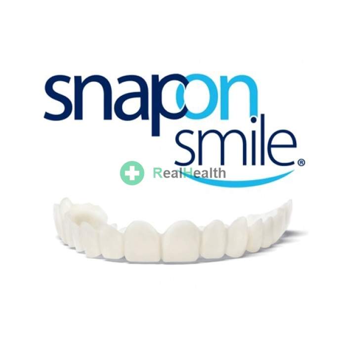 Snap-On Smile - dýhy